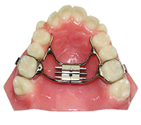 palatal expander model